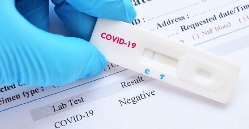 Việc test nhanh COVID-19 sớm có thể cho kết quả không chính xác