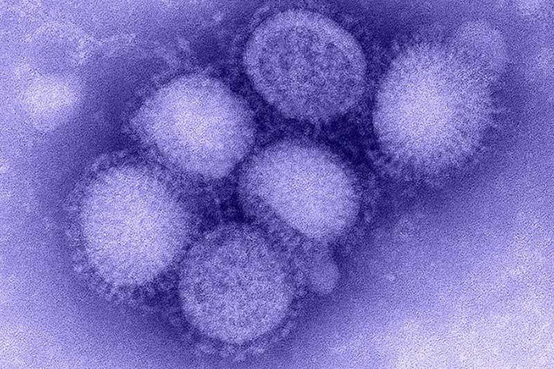 benh-cum-a-h1n1-co-nguy-hiem-va-de-lay-khong