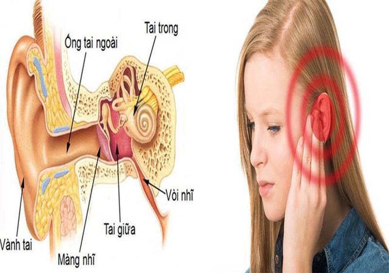 Tắc vòi nhĩ là một trong những nguyên nhân gây viêm tai giữa ứ dịch