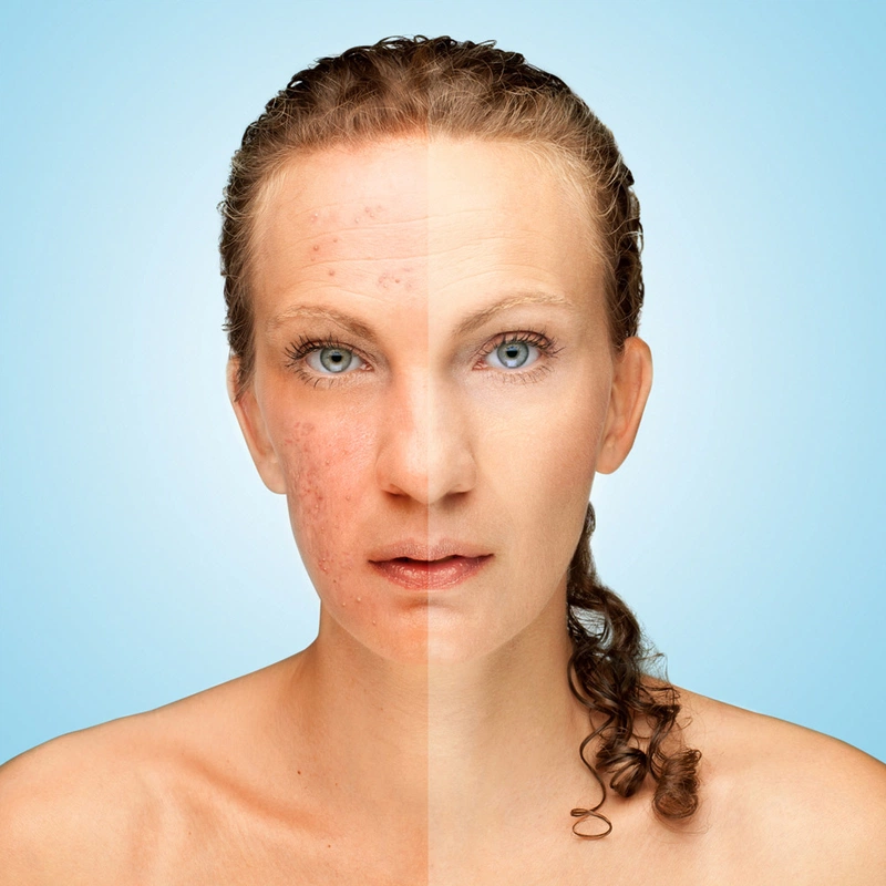 Da mặt bị dị ứng và cách điều trị 1