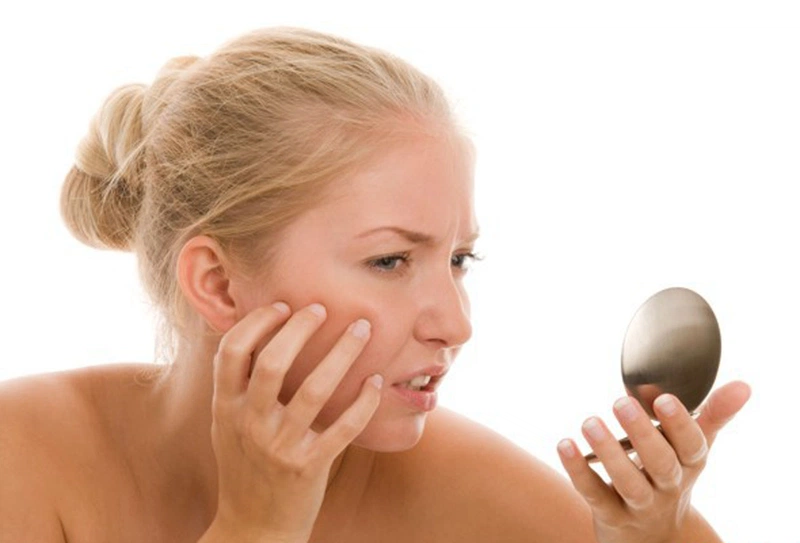 Da mặt bị dị ứng và cách điều trị 3