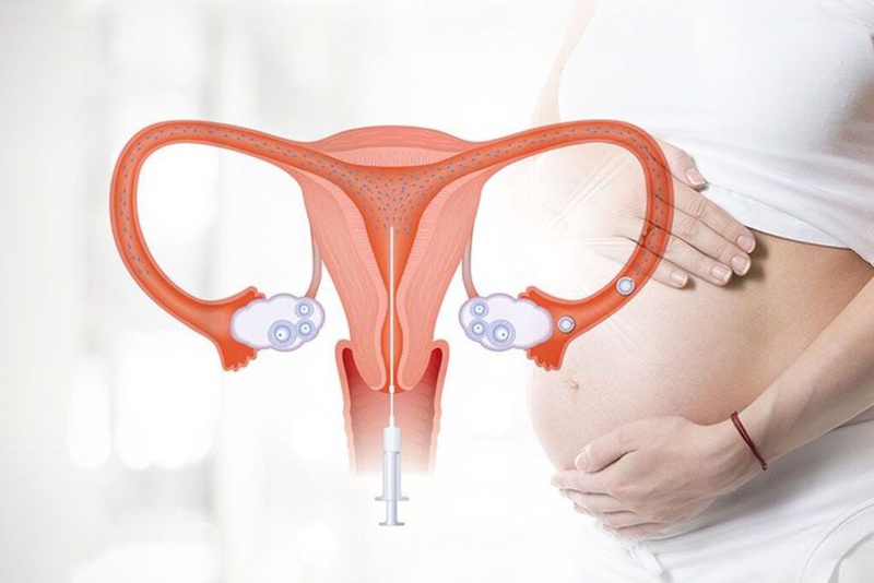 Đa nang buồng trứng có làm IUI được không? 3