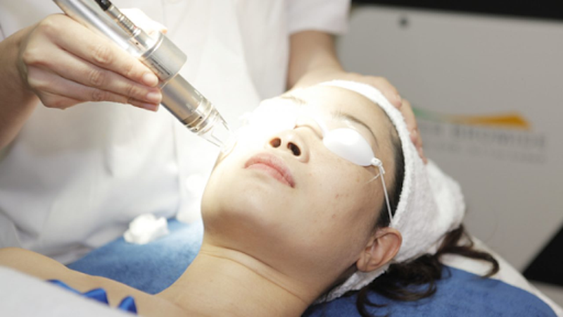Da tàn nhang bẩm sinh có điều trị dứt điểm hoàn toàn được không? 2