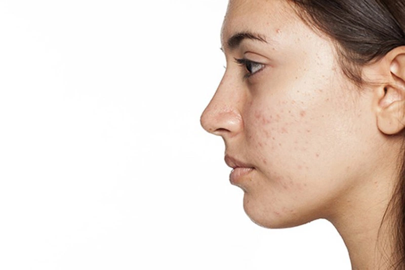 Những công dụng làm đẹp bất ngờ của son môi mà nhiều người không biết 4