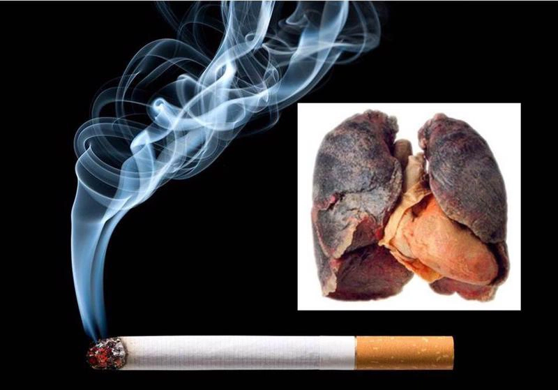 Đang điều trị lao phổi có hút thuốc lá được không?3