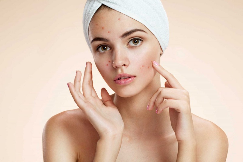Đánh bay nỗi lo của các chị em bằng sữa rửa mặt trị mụn ẩn 1