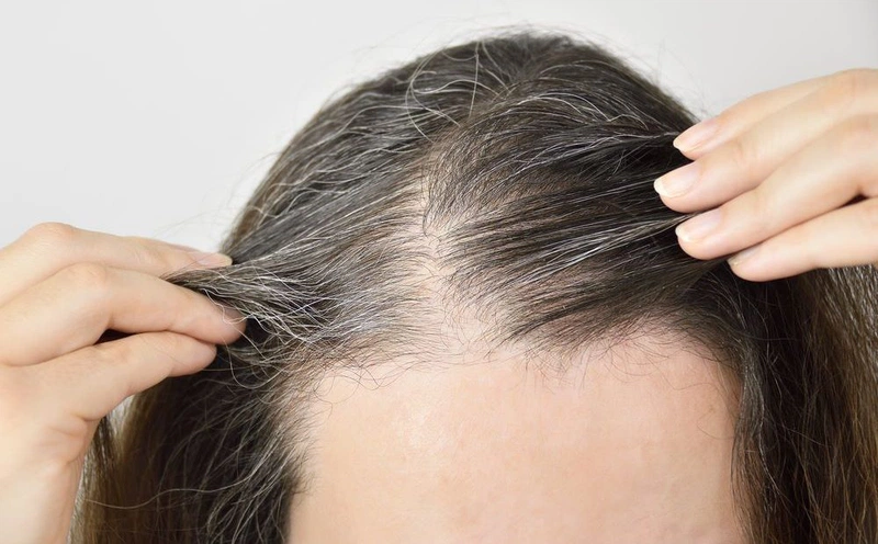 Đau đầu với những bệnh thường gặp ở tóc 2