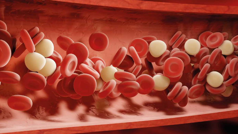 Rối loạn lipid máu hay còn gọi là máu nhiễm mỡ là do lượng mỡ trong máu tăng cao