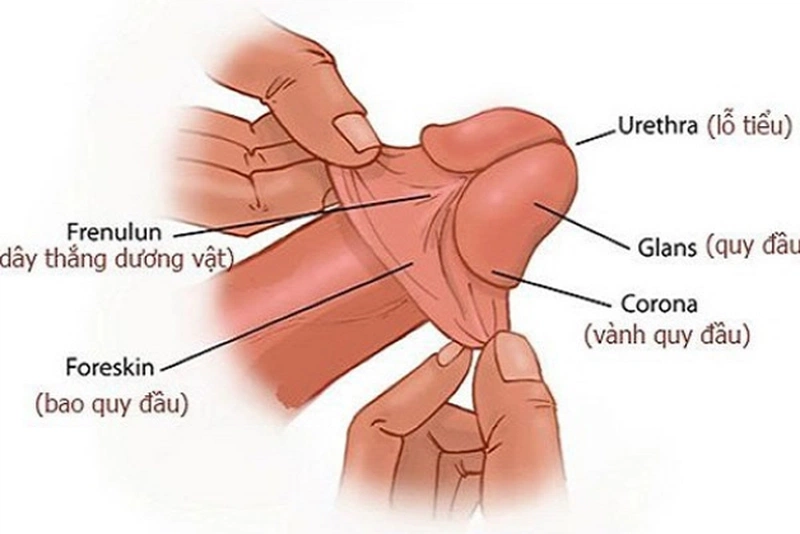 Lột bao quy đầu là phẫu thuật tách lớp da bao quy đầu ra và để lộ quy đầu