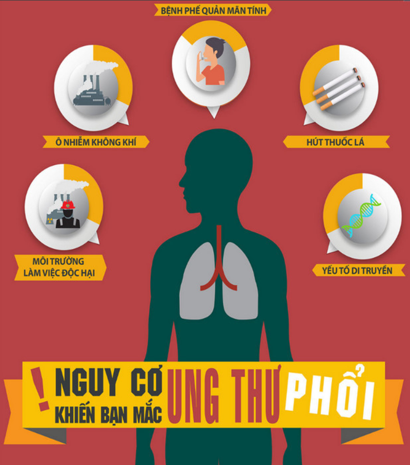 [Cảnh báo] Dấu hiệu ung thư phổi ở nam giới không nên bỏ qua 3