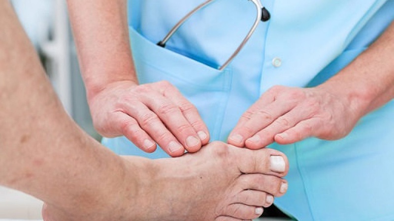 Đau khớp bàn chân phải và cách điều trị phù hợp2