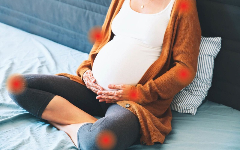 Đau khớp gối bà bầu: Làm sao xử lý? 1