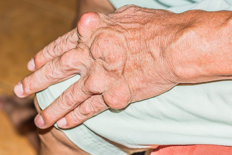 Đau khớp gối không rõ nguyên nhân có nguy hiểm không? Làm sao để chẩn đoán? 2