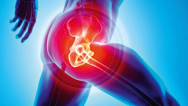 Nguyên nhân gây đau khớp háng ở nam giới 2