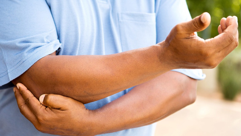 Đau khớp khuỷu tay là bệnh gì? Nguyên nhân, triệu chứng và cách điều trị1