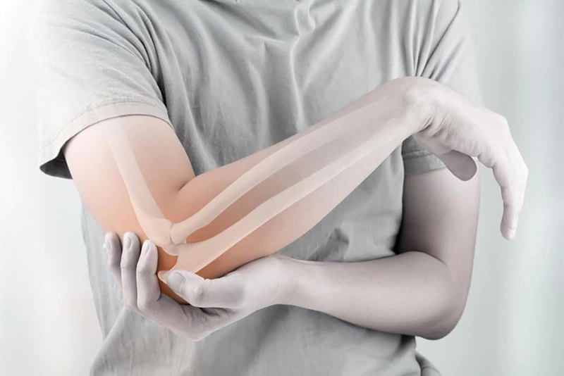 Đau khớp khuỷu tay phải: Dấu hiệu, biến chứng và cách điều trị2