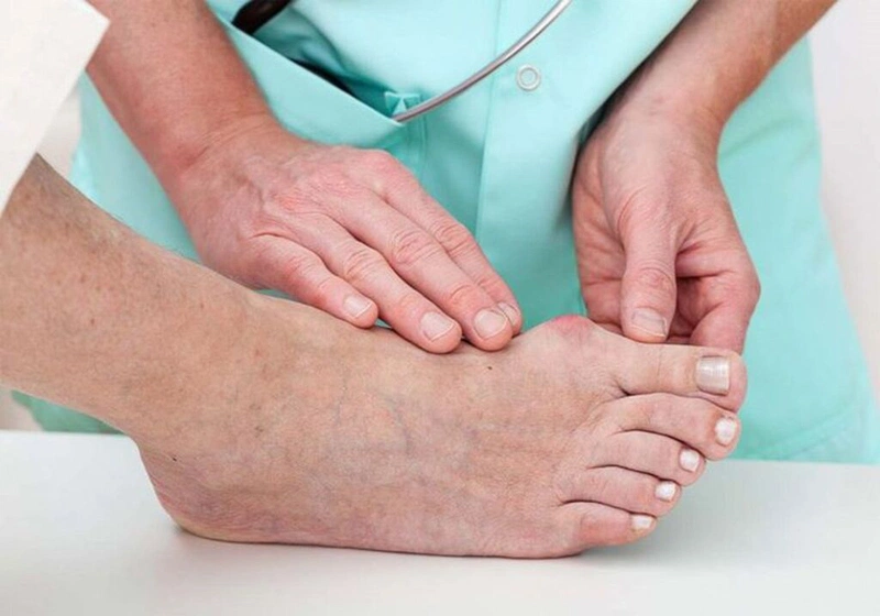 Đau khớp ngón chân cái bên phải là dấu hiệu bệnh gì 1