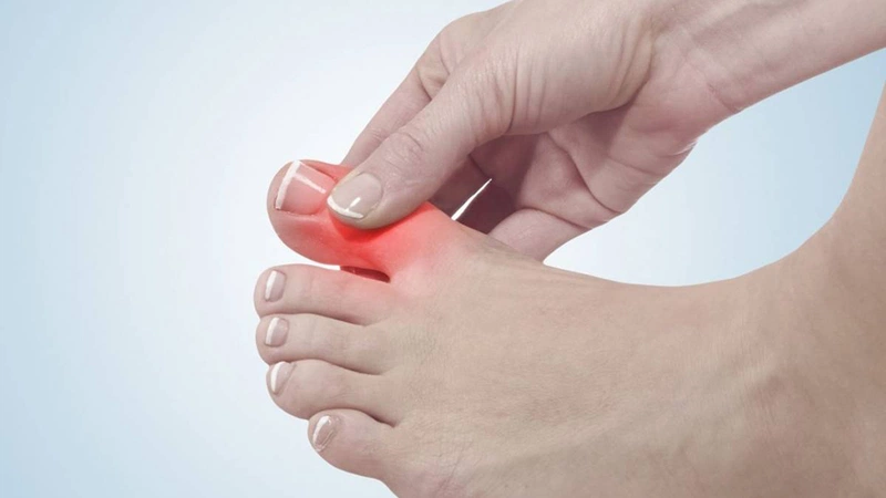 Đau khớp ngón chân cái không sưng có sao không 1