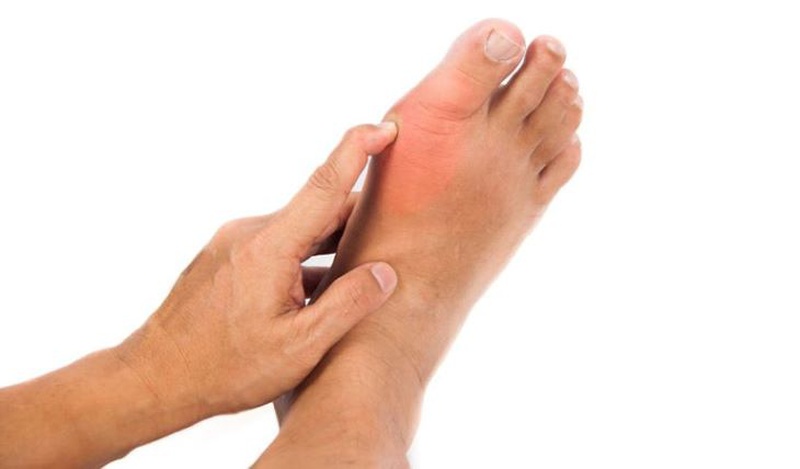 Đau khớp ngón chân cái là bệnh gì? Bật mí các cách giảm đau hiệu quả tại nhà 4