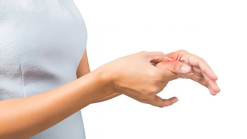 Đau khớp ngón tay cái sau sinh: Nguyên nhân và cách điều trị 2
