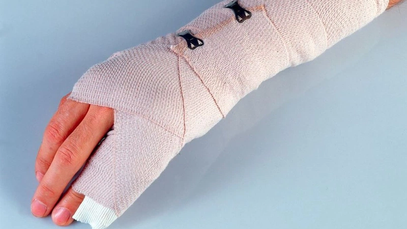 Đau khớp ngón tay út: Nguyên nhân và cách chữa trị 2