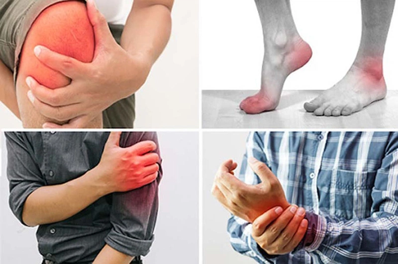 Đau khớp tê tay là bệnh gì? Nguyên nhân do đâu? 2