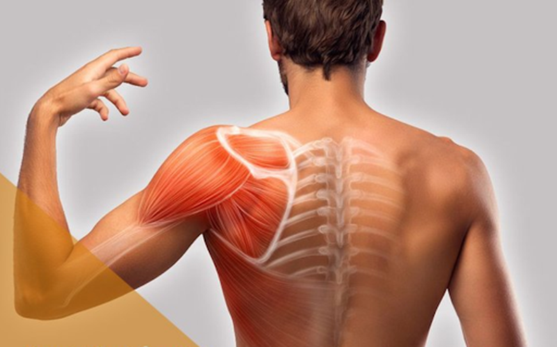 Đau khớp vai bên trái và những điều bạn cần biết