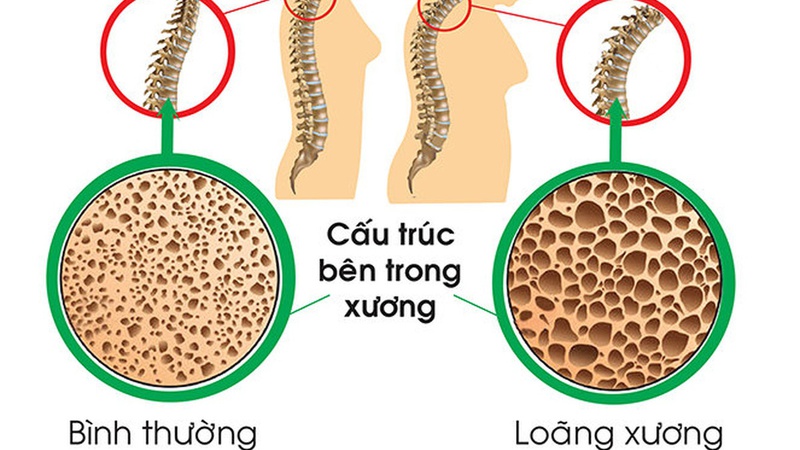 Đâu là tư thế ngủ cho người đau lưng nên biết? 1
