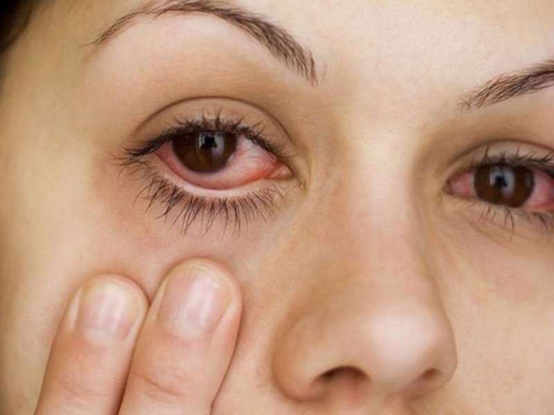 các triệu chứng đau mắt hột 2