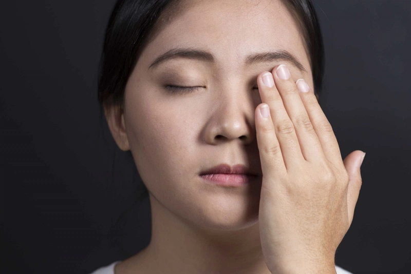 Đau mắt đỏ nhỏ vigamox có nên không? 1