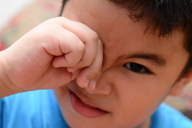 Đau mắt đỏ phù nề: Căn bệnh ai cũng sợ khi mùa nóng đến 3