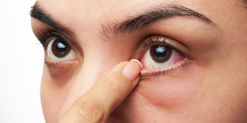 Tìm hiểu: Bệnh đau mắt đỏ truyền qua đường nào? 1