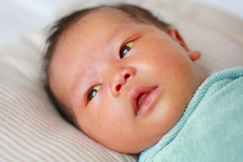 Đau mắt ở trẻ sơ sinh và những điều cần biết 3