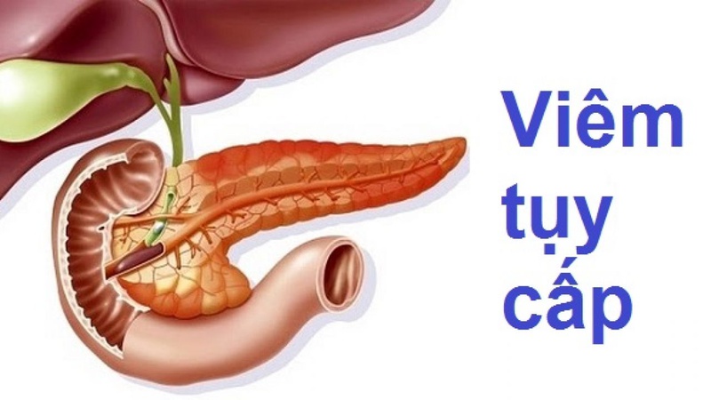 Đau thượng vị buồn nôn báo hiệu điều gì? 3