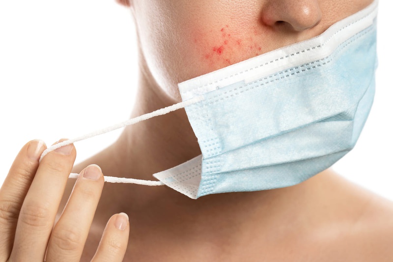 Bạn đã biết các tiêu chí để chọn mua khẩu trang chất lượng chưa? 3