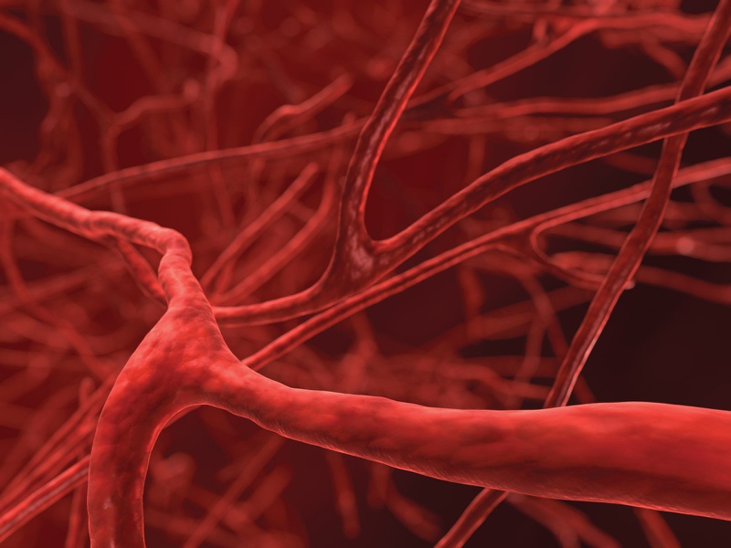 Dị dạng mạch máu là gì? Có bao nhiêu loại dị dạng mạch máu? 1