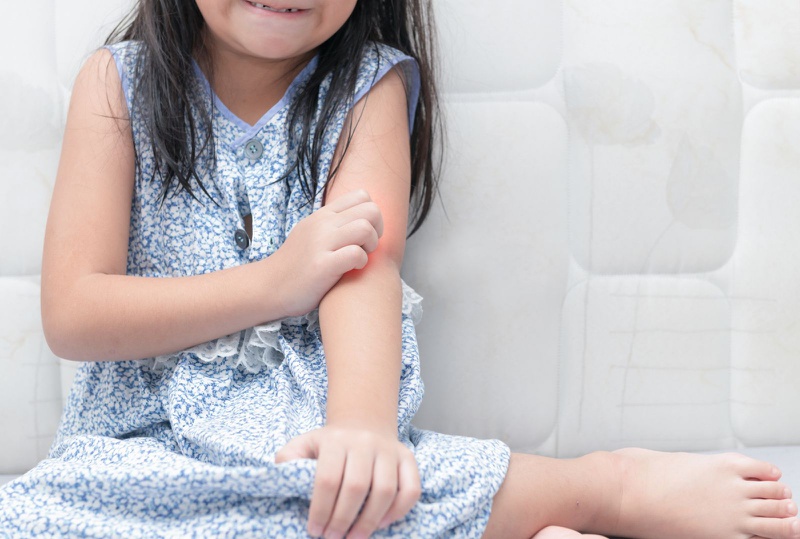 Dị ứng thời tiết ở trẻ em: Nguyên nhân, triệu chứng và cách điều trị hiệu quả 3