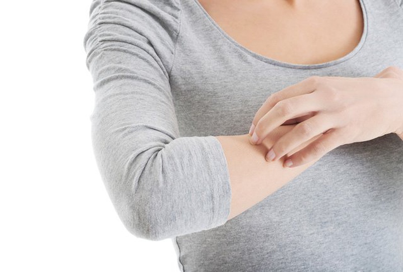 Dị ứng thuốc: Dị ứng thuốc muỗi2