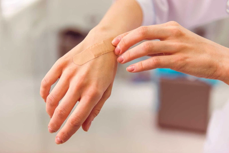 Địa chỉ trị sẹo lồi uy tín tại Hà Nội 2