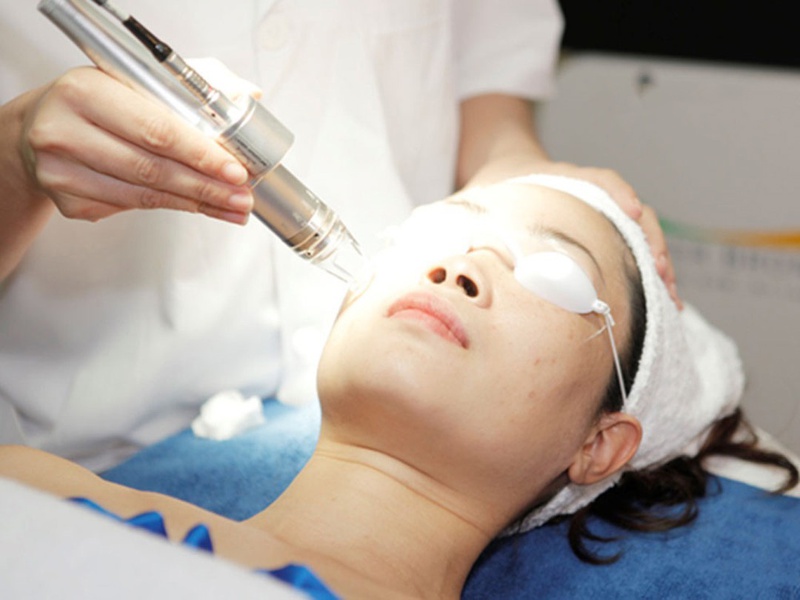Phương pháp laser màu xung cũng là phương pháp trị sẹo lồi được nhiều chuyên gia đánh giá cao