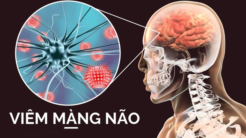 Điểm mặt những dấu hiệu quai bị dễ nhận biết 2