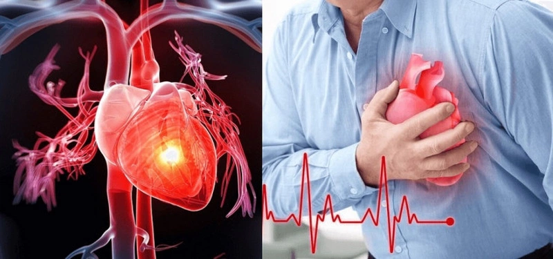 Hạt điều rất tốt nhưng bệnh gì không nên ăn hạt điều? 4