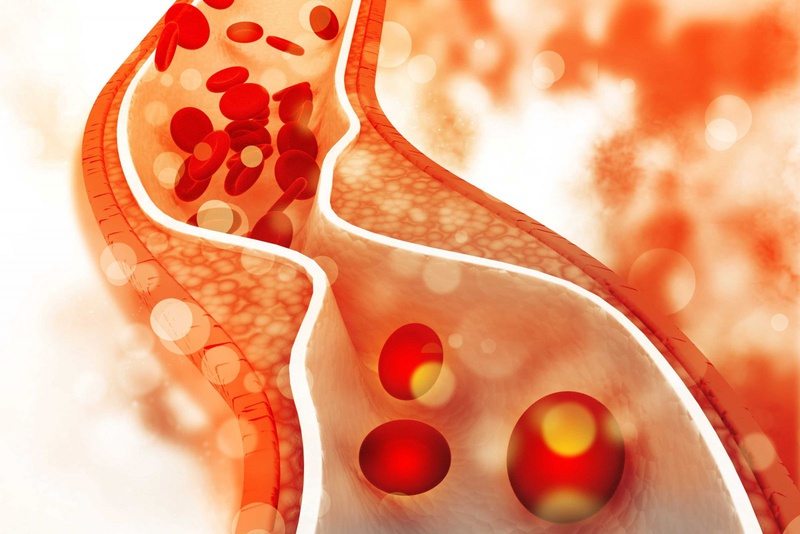 Điều gì tác động tới Cholesterol trong máu? 1