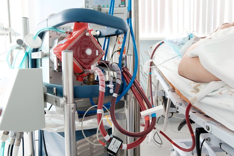 Điều trị ECMO là gì? 