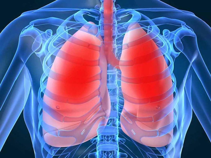 Điều trị lao phổi tại nhà cần chú ý những gì?1