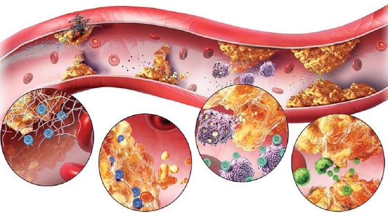 Nguyên tắc điều trị rối loạn lipid máu là kết hợp giữa thuốc và lối sống lành mạnh