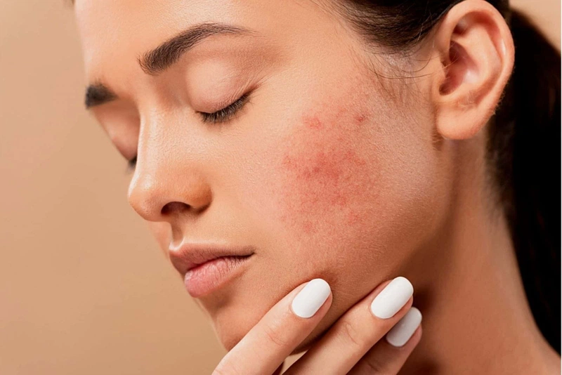 Điều trị rối loạn nội tiết tố nữ tự nhiên các chị em nên biết 1