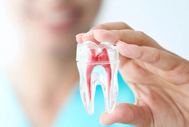 Điều trị tủy răng có đau không và khi nào cần điều trị