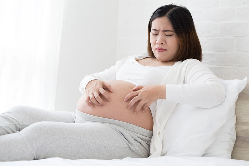 Điều trị viêm da cơ địa khi mang thai như thế nào cho an toàn 1