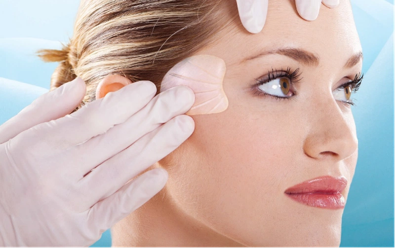 Độn thái dương bằng sụn là gì?4
